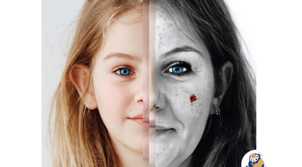 Ilustracija (Foto: Euromelanom)