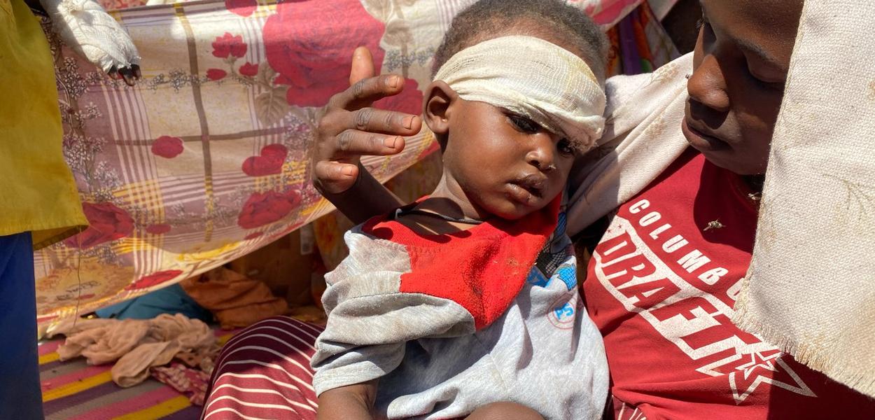 Jedno sudansko dijete, koje je zajedno sa porodicom pobjeglo iz grada El-Fašer nakon što su sudanske parapolicijske snage napale zapadni region Darfur, prima medicinsku pomoć u kampu u Tawili, Sudan, Nov. 2, 2025. (Foto: AP photo/Mohammed Abaker)